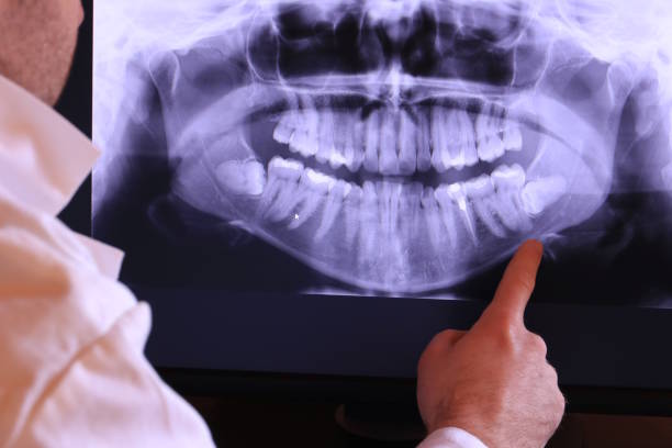 Best Broken or Cracked Tooth Emergency Dentist in Satsuma, AL