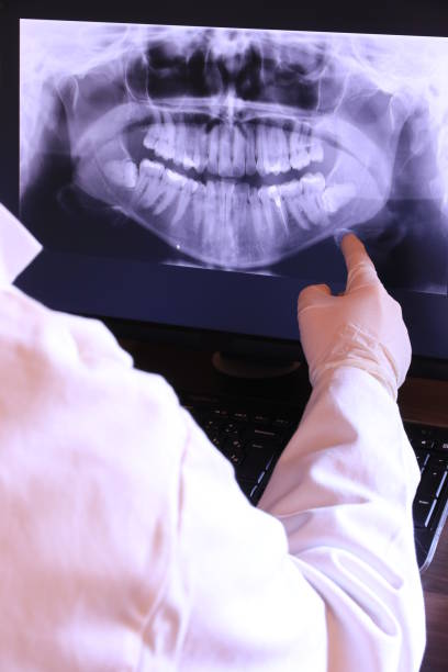 Best Emergency Dentist for Knocked-Out Tooth in Satsuma, AL