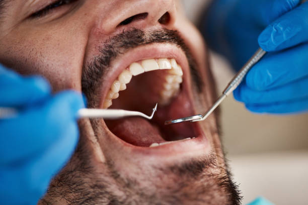 Best Emergency Dental Services for Seniors in Satsuma, AL